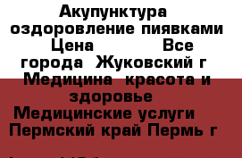 Акупунктура, оздоровление пиявками › Цена ­ 3 000 - Все города, Жуковский г. Медицина, красота и здоровье » Медицинские услуги   . Пермский край,Пермь г.